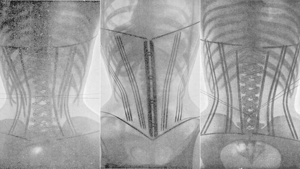 Corseted X-Rays from "Le Corset," 1908.